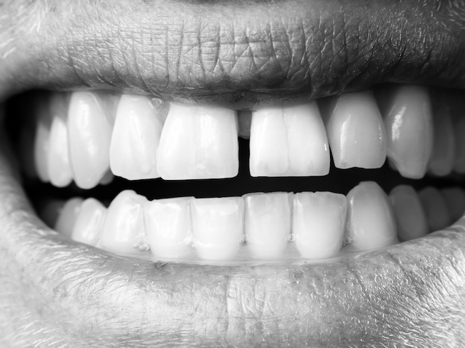 Ganslmeier & Zibelnik, aus: Bereitschaft, 2024–2025.